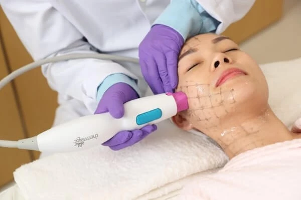 Khách hàng đang trải nghiệm công nghệ trẻ hóa da Thermage.